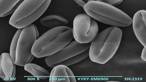 图片电镜下的花粉粒