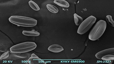 图片电镜下的花粉粒