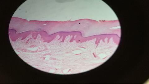 图片皮肤上皮细胞