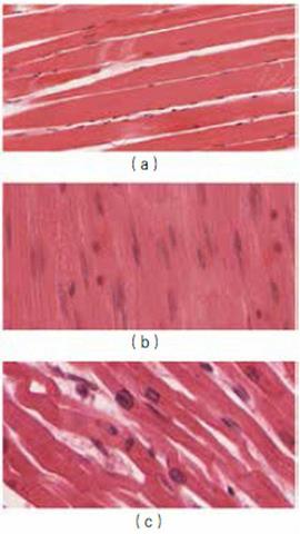 图片一种肌细胞