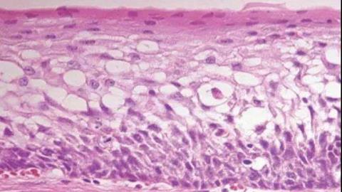 图片消化道上皮