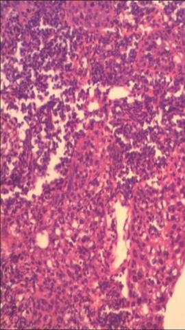 图片消化道上皮