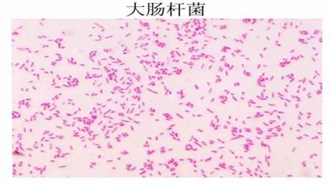 图片大肠杆菌