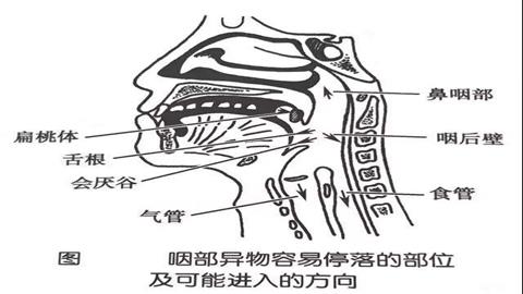 图片会厌软骨与吞咽和呼吸的关系