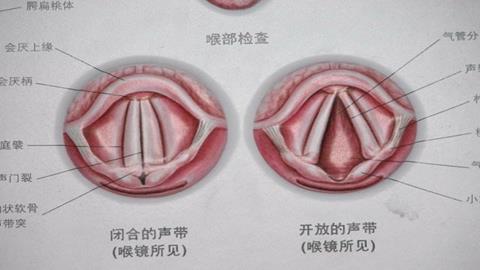 图片声带拉紧与松开