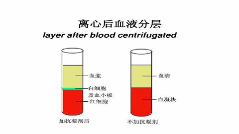 图片血液分层示意图