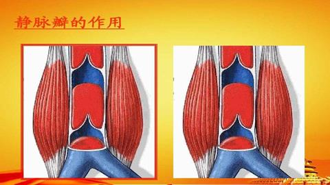 图片静脉瓣示意图