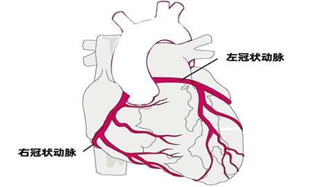 图片冠状动脉示意图（不同颜色表示冠状动脉分支到达的不同区域）