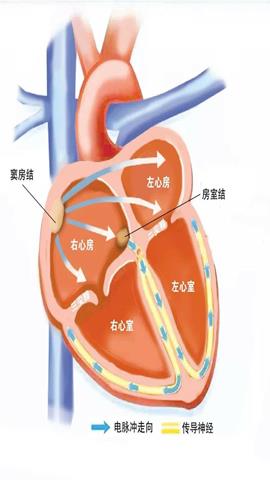 图片心脏的结构示意图