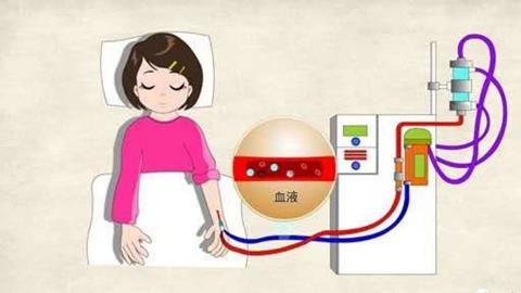 图片血液透析示意图