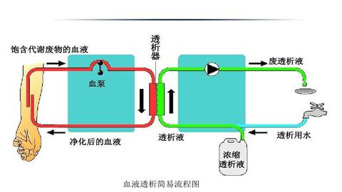 图片肾透析原理示意图