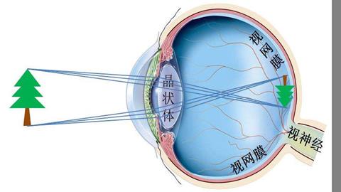 图片物体在视网膜上成像