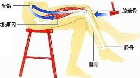 图片膝跳反射
