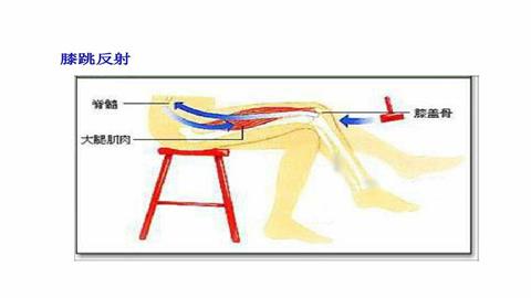 图片膝跳反射示意图