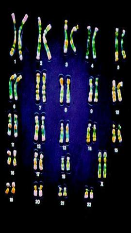 图片女性染色体组型