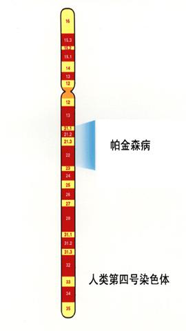 图片第四号染色体和帕金森病