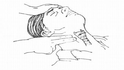 图片判断病人是否心跳恢复