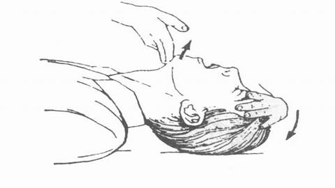 图片人工呼吸－抬起下颌